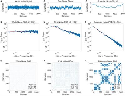 Frontiers | The Nonlinearity Of Pupil Diameter Fluctuations In An ...